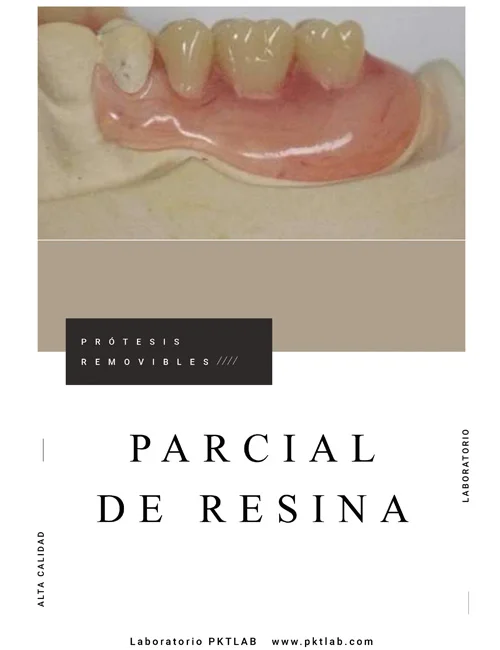 protesis parciales de resina